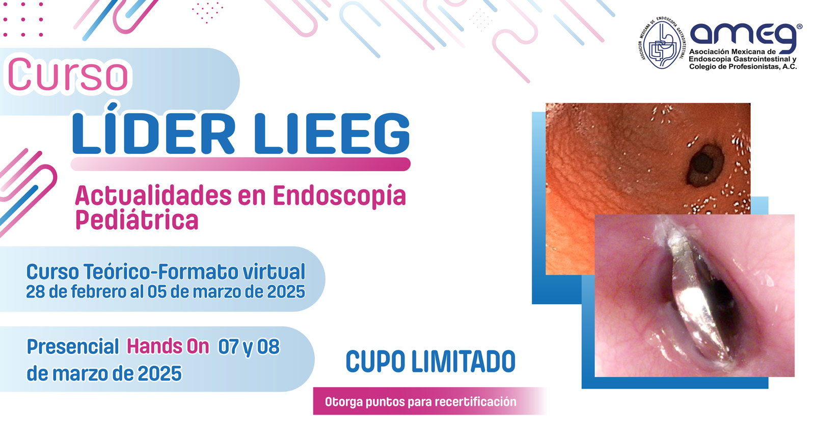 Curso LIEEG: Actualidades en Endoscopía Pediátrica