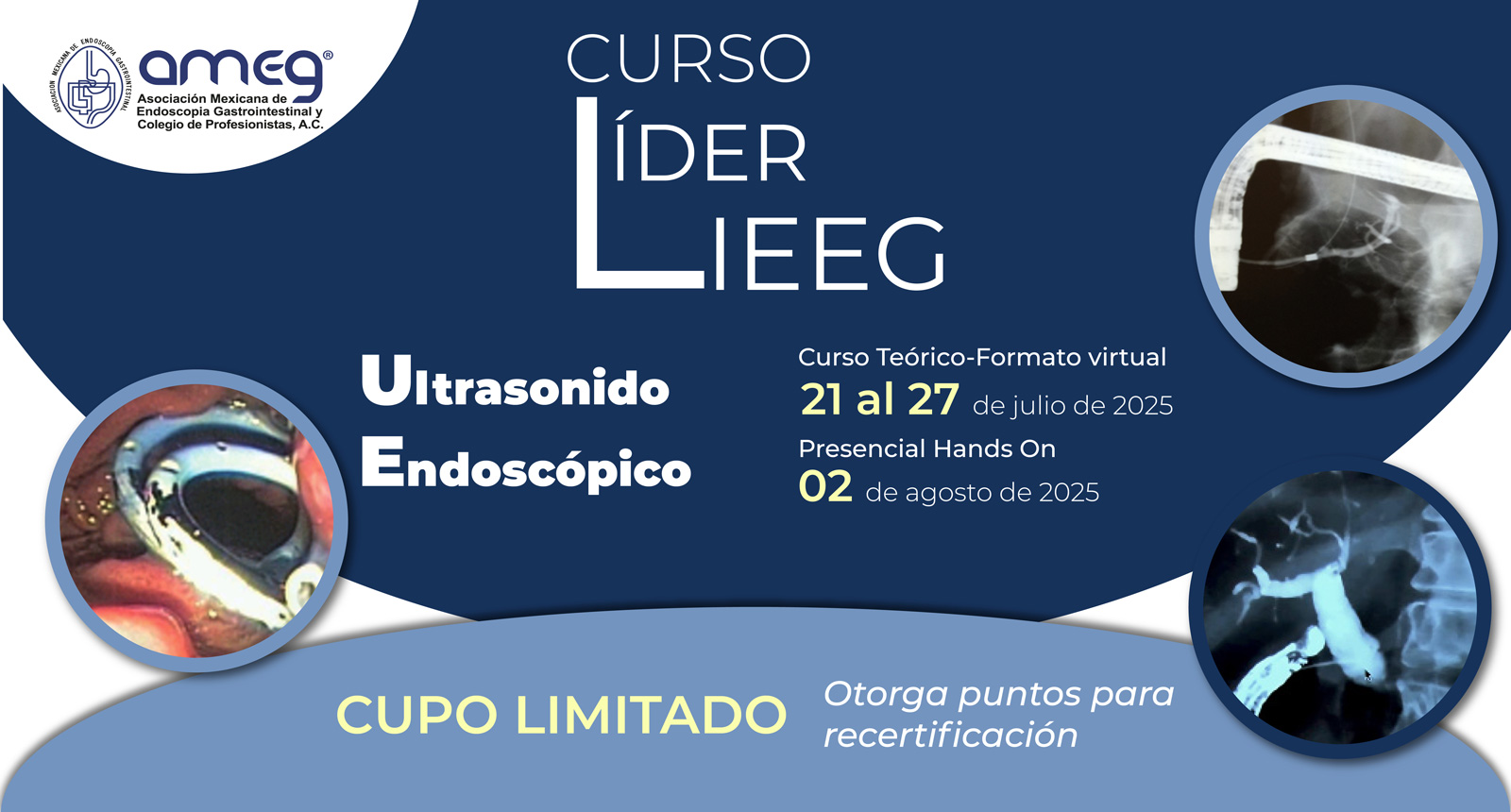 Curso LIEEG: Ultrasonido Endoscópico